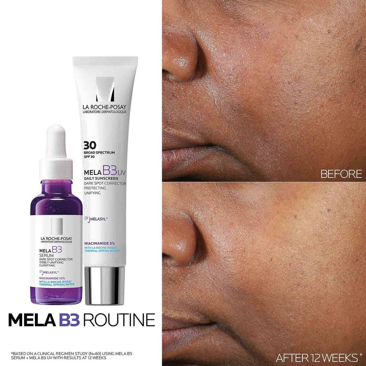 mela-b3-dark-spot-serum-and-mela-b3-uv-daily-moisturizer-with-spf-30-p5 3-Mela-B3-routine_1500X1500.jpg