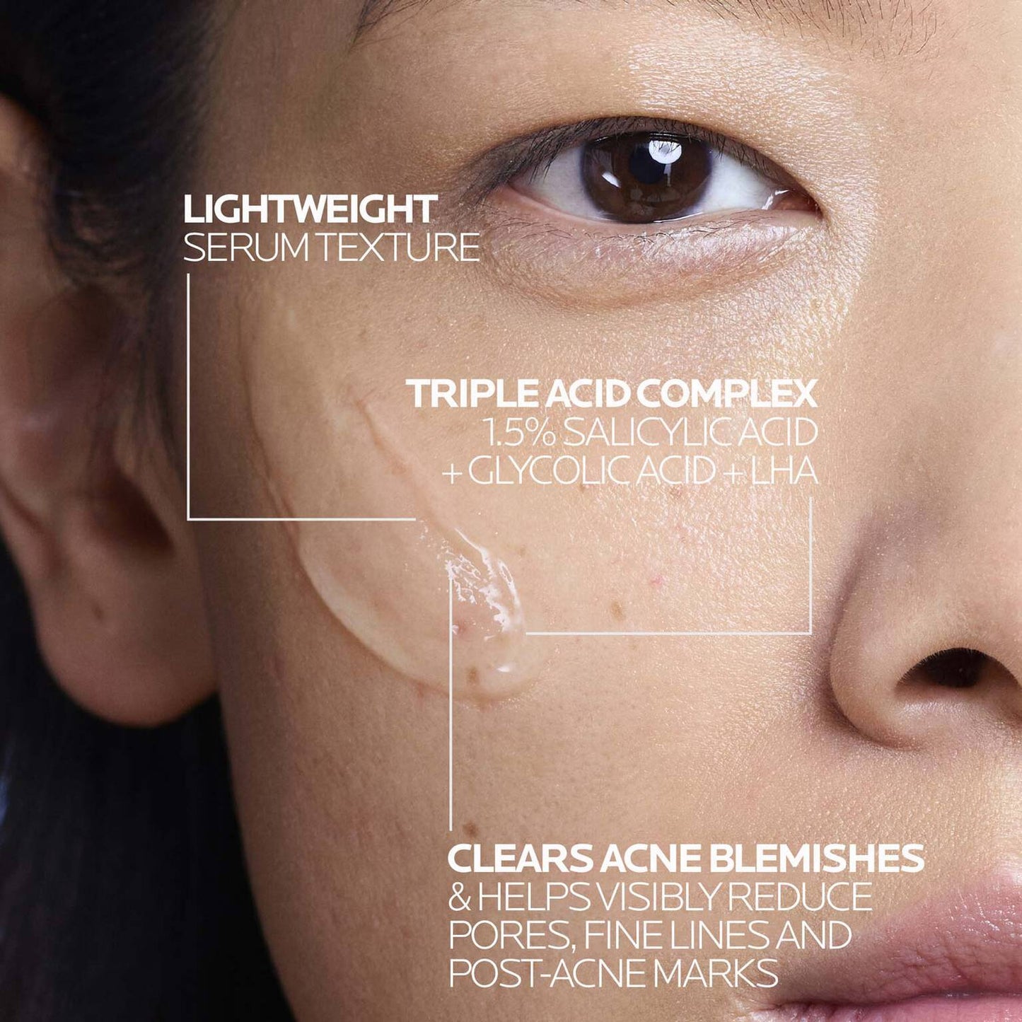 effaclar-salicylic-acid-acne-treatment-serum-c6 LaRochePosay-Product-Effaclar-Effaclar-Serum-30ml-3337875722827-Texture-REV.jpg