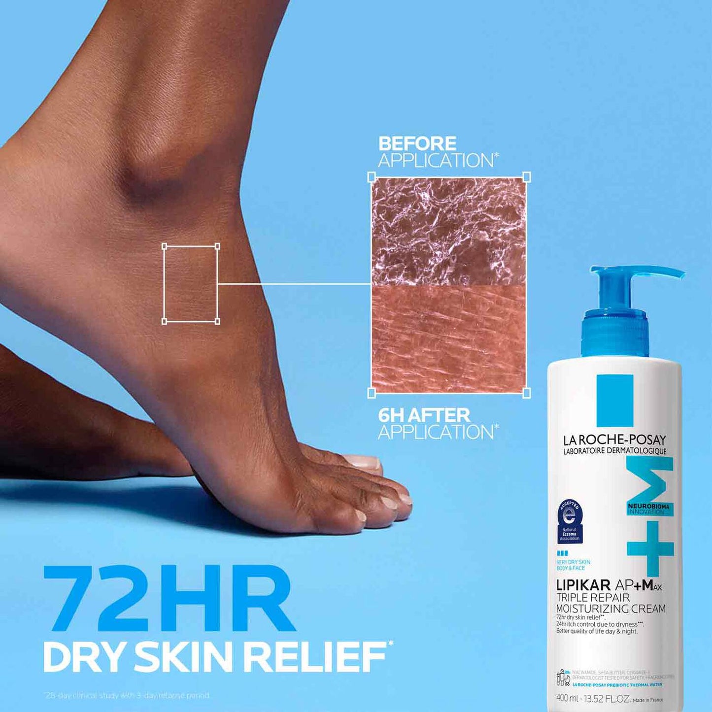 lipikar-ap-max-triple-repair-moisturizing-cream-j6 LaRochePosay-Product-Skincare-Lipikar-Balm-AP+MAX-400ml-3337875941150-ATF-PIM-BeforeAfter.jpg
