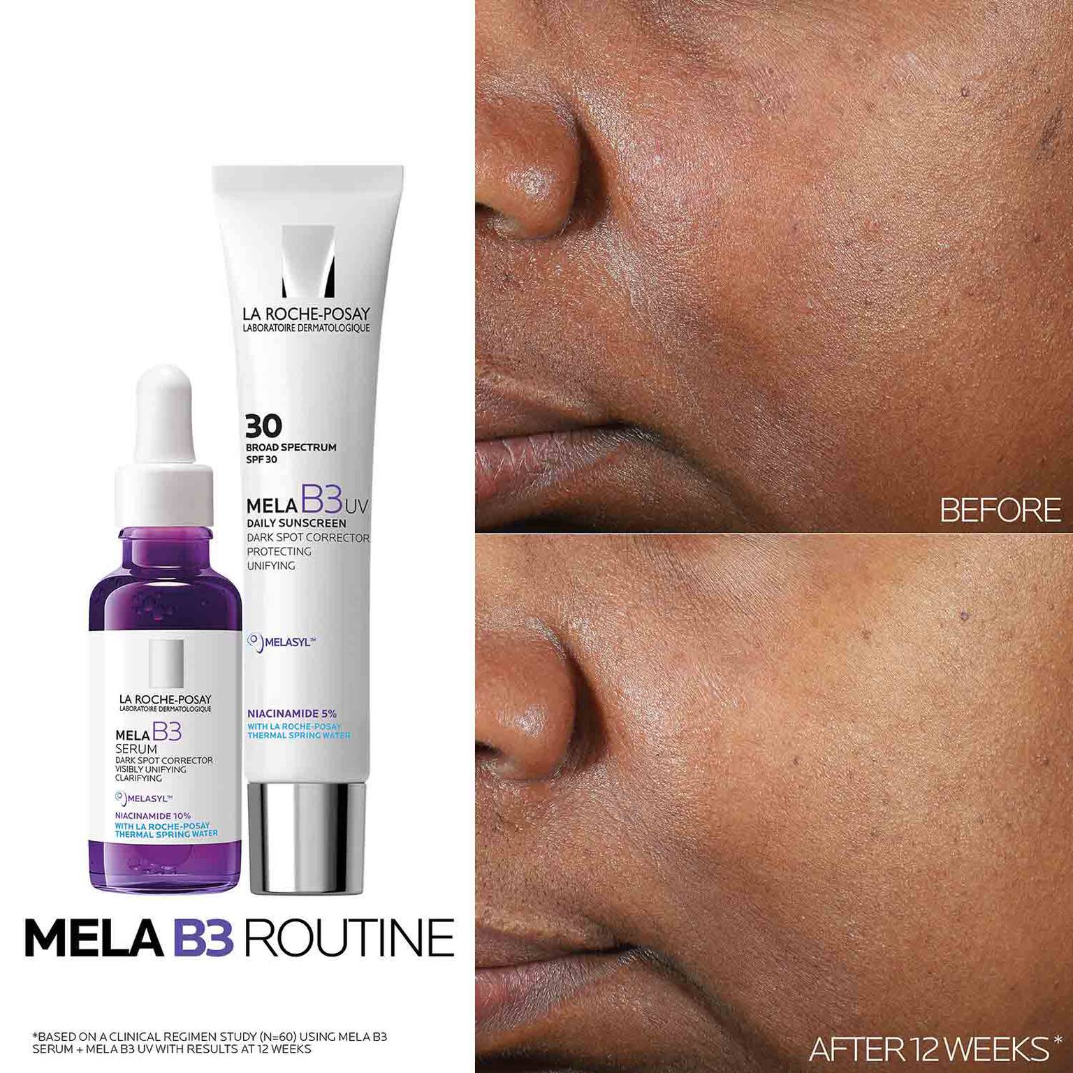 mela-b3-dark-spot-serum-with-melasyltm-niacinamide-l7 Mela-B3-routine_1500X1500.jpg