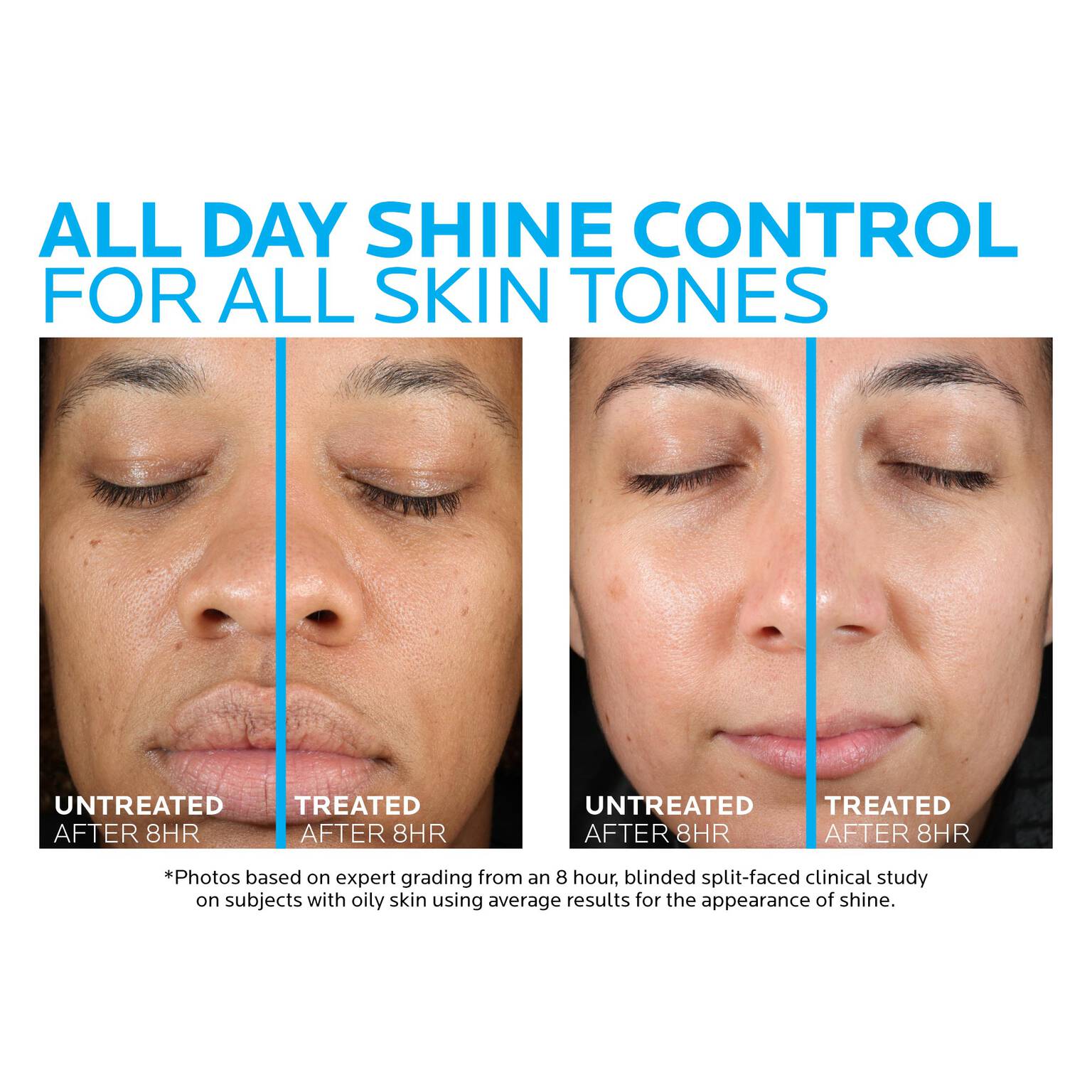 toleriane-double-repair-matte-face-moisturizer-for-oily-skin-s8 la-roche-posay-toleriane-matte-moisturizer-before-and-after-pdp-alt.jpg